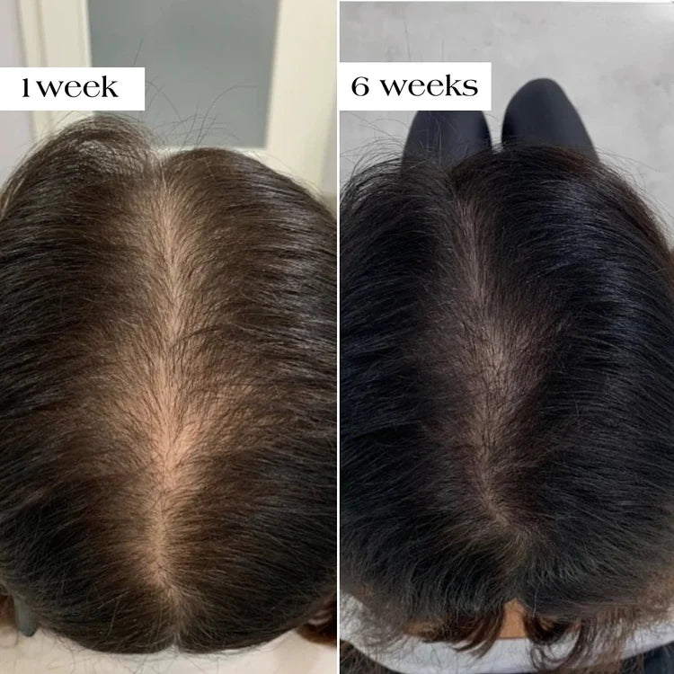 Before and after hair photo